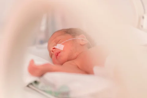 Photograph of small, premature infant in the NICU.